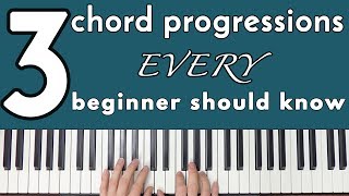 Common Chord Progressions Every Beginner Should Know [upl. by Gravante329]