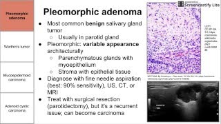 Salivary Gland Neoplasms [upl. by Sutherlan]