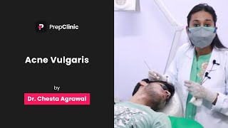 Acne Vulgaris  Dr Chesta Agrawal  Dermatology PrepClinic [upl. by Blockus]