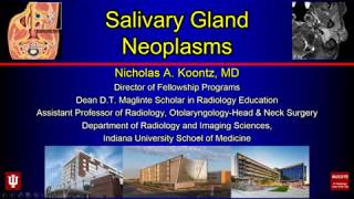 Salivary Gland Neoplasms [upl. by Etnohc]