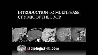 Introduction to Multiphase CT amp MRI of the Liver [upl. by Alekal]